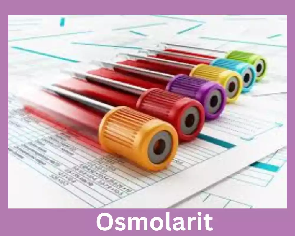 Osmolarit