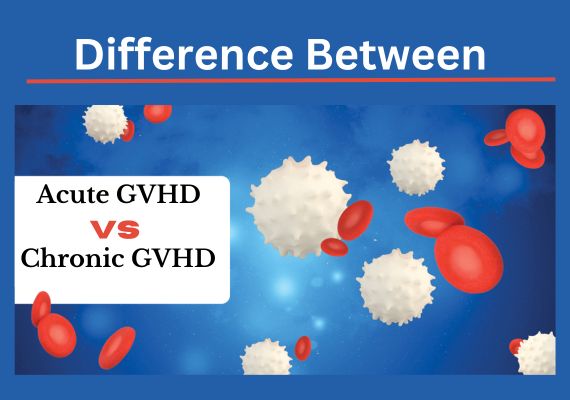Acute and Chronic GVHD