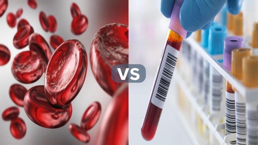 Hemoglobin and Hematocrit