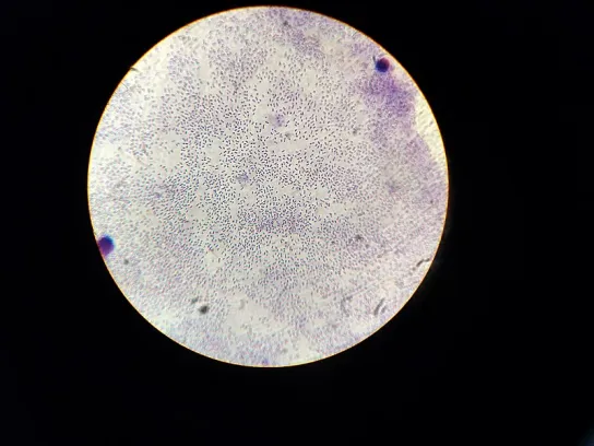 Diplococcus Pneumoniae