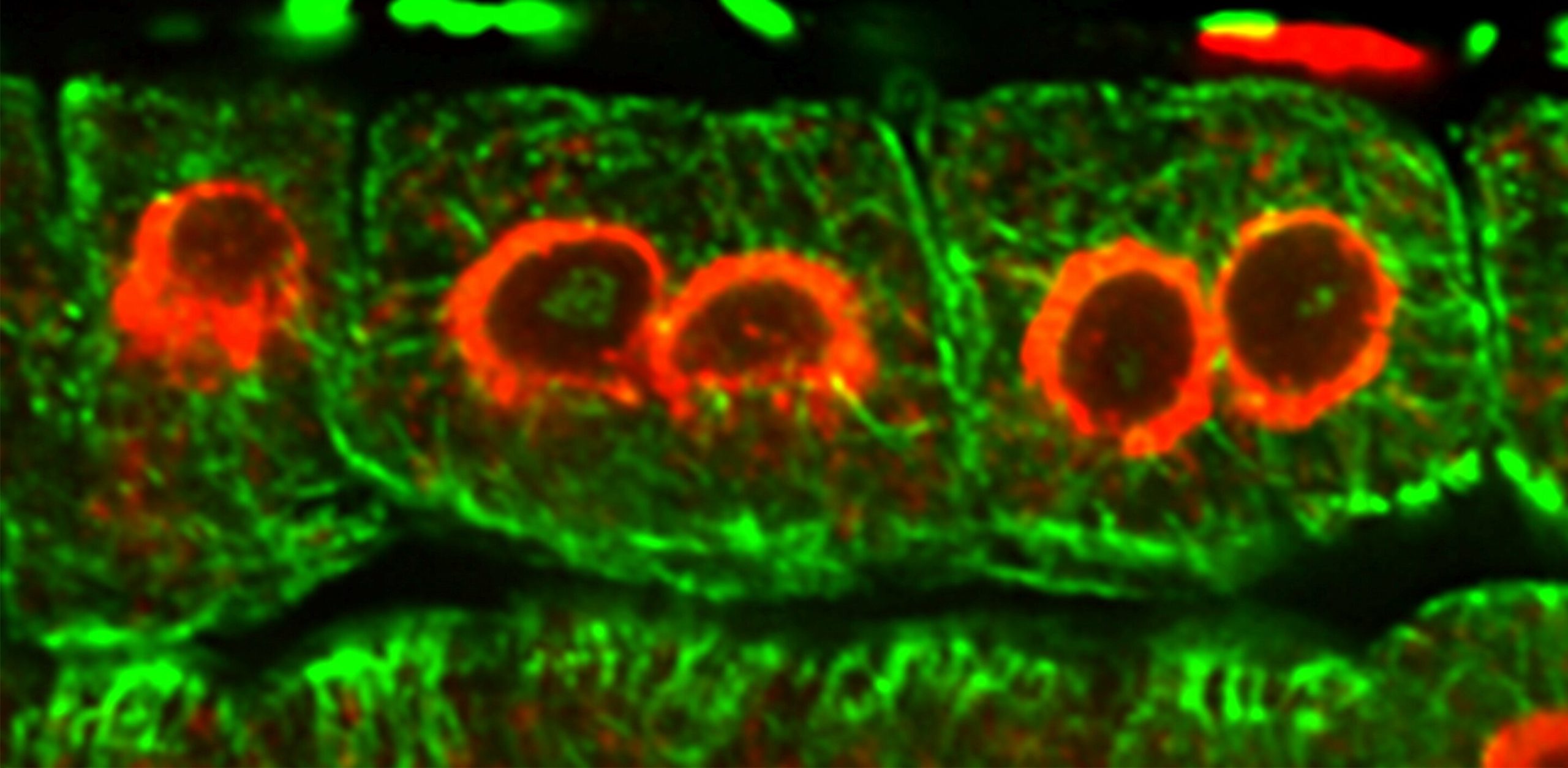 Plant Mitosis