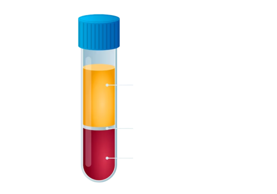 Sucrose Centrifugation