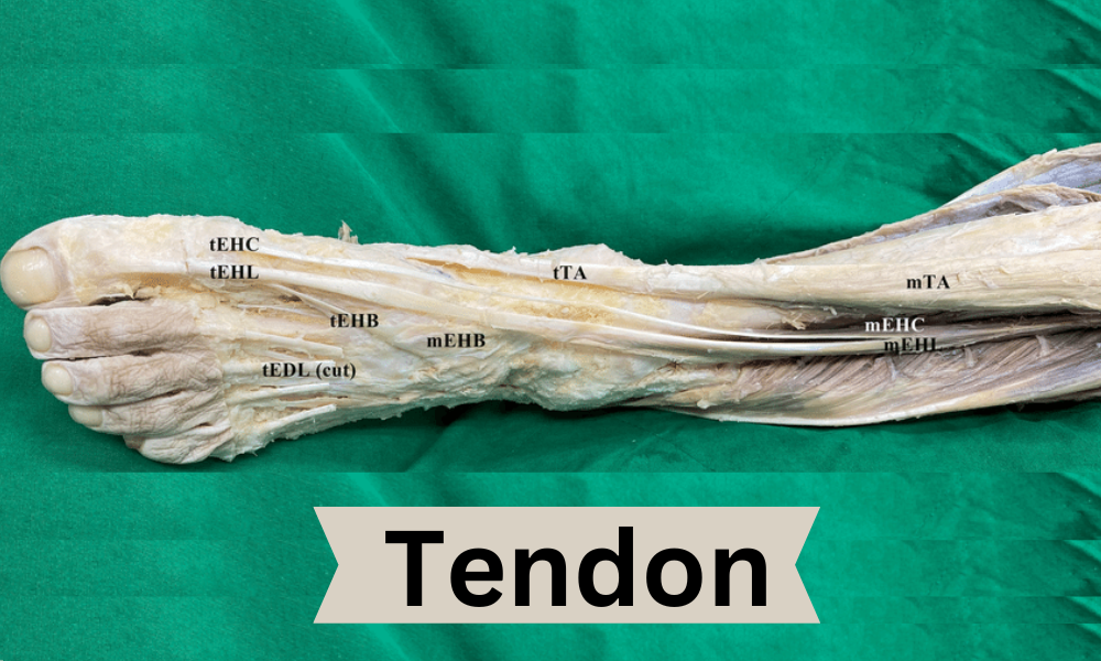 Tendon