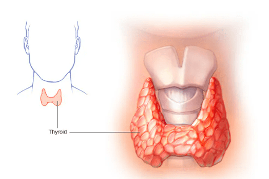 Underactive Thyroid